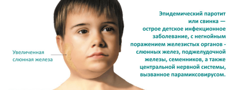 Фото: Симптомы паротита у мальчиков